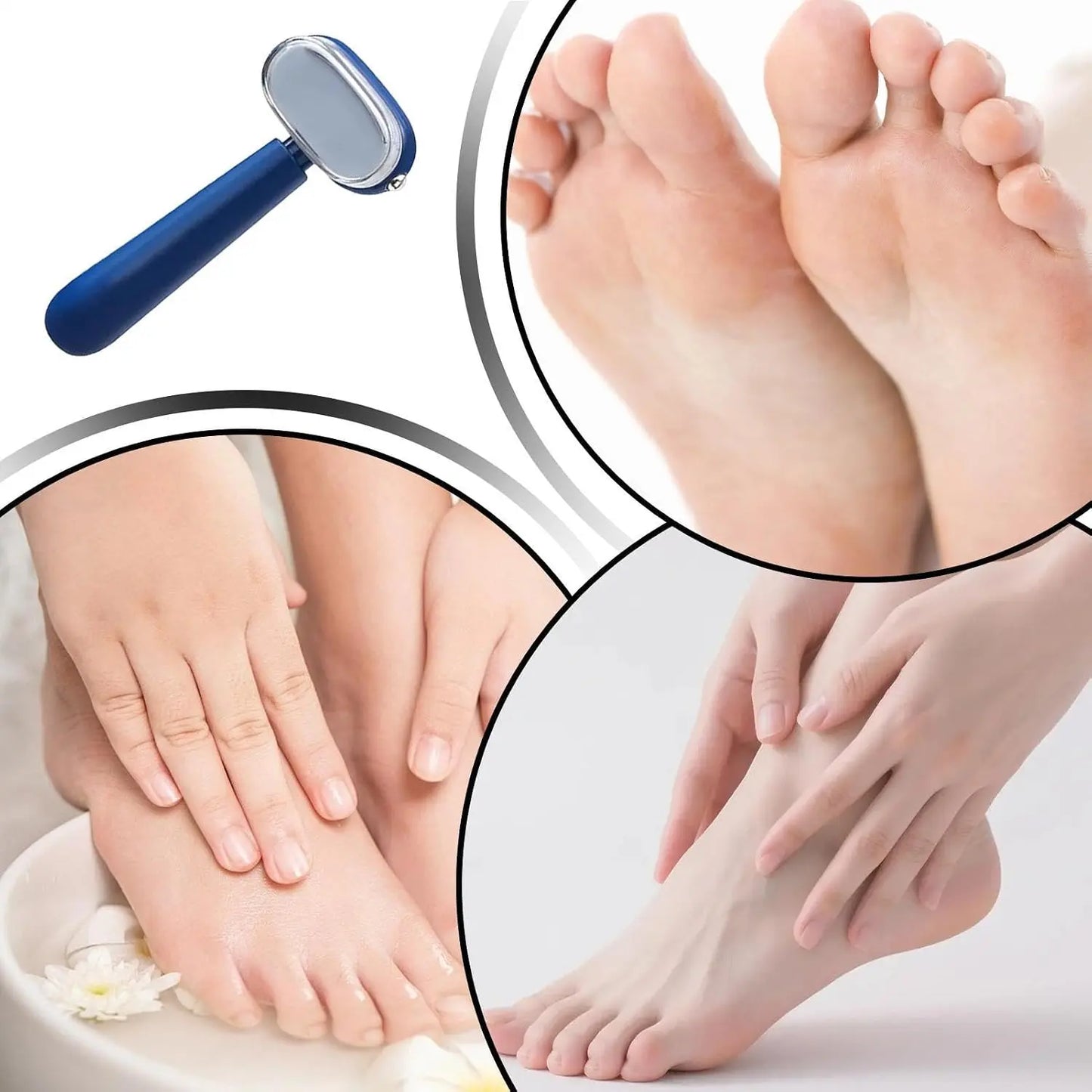 Dual‑Sided Foot Callus Remover 🦶